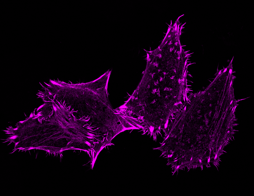 Ученые создали новый тип клеточного биосенсора пероксида водорода с возможностью выбора цвета флуоресценции